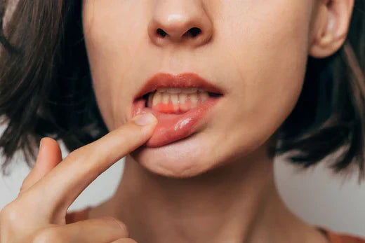 Closeup of woman examining her inner lip for gum health.