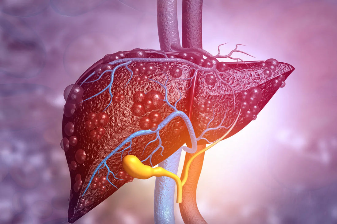 Illustration of a human liver showing fatty deposits and anatomical details.