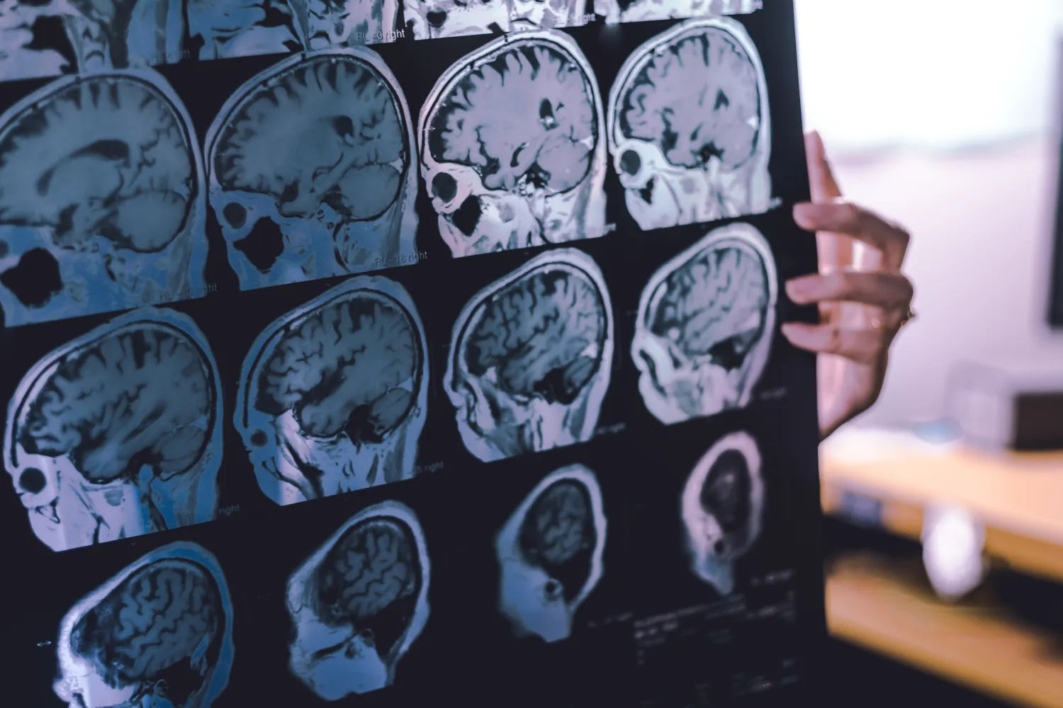 Is Dementia a Normal Part of Aging?