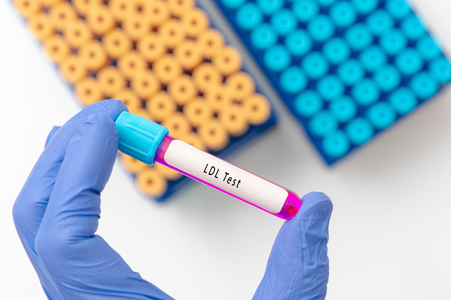 Gloved hand holding an LDL test vial in a lab setting.
