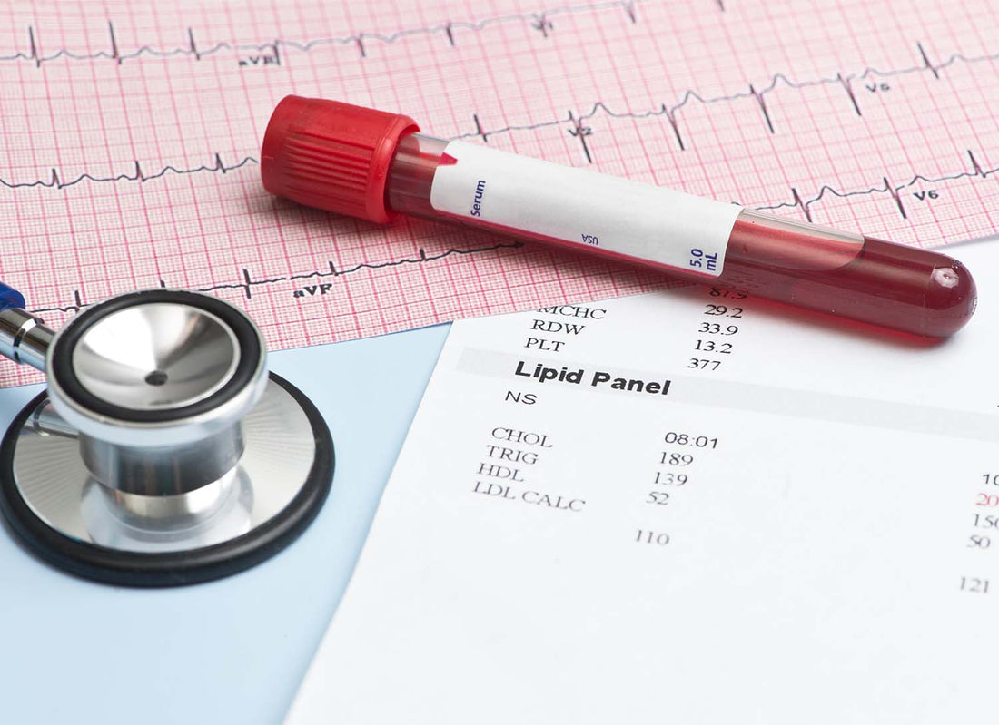Blood test tube, stethoscope, and lipid panel results on a table.