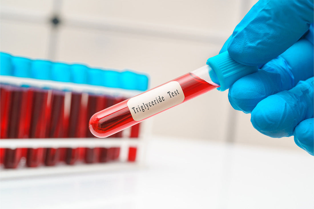 Gloved hand holding triglyceride test tube in lab.