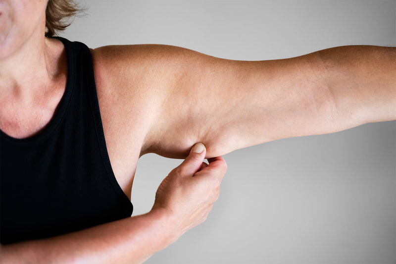Woman pinching arm skin for elasticity check.